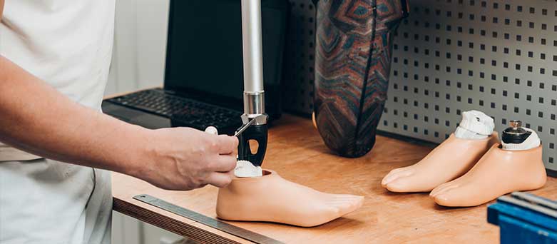 Prosthetist at work
